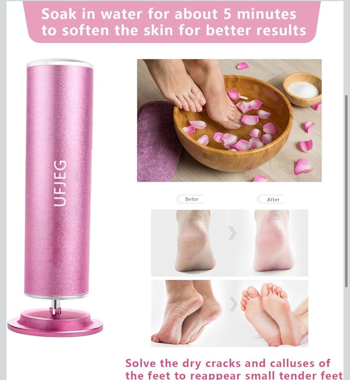 (NEW MSRP $24.99) Electric Callus Remover – Adjustable Speed, 60 Sandpapers