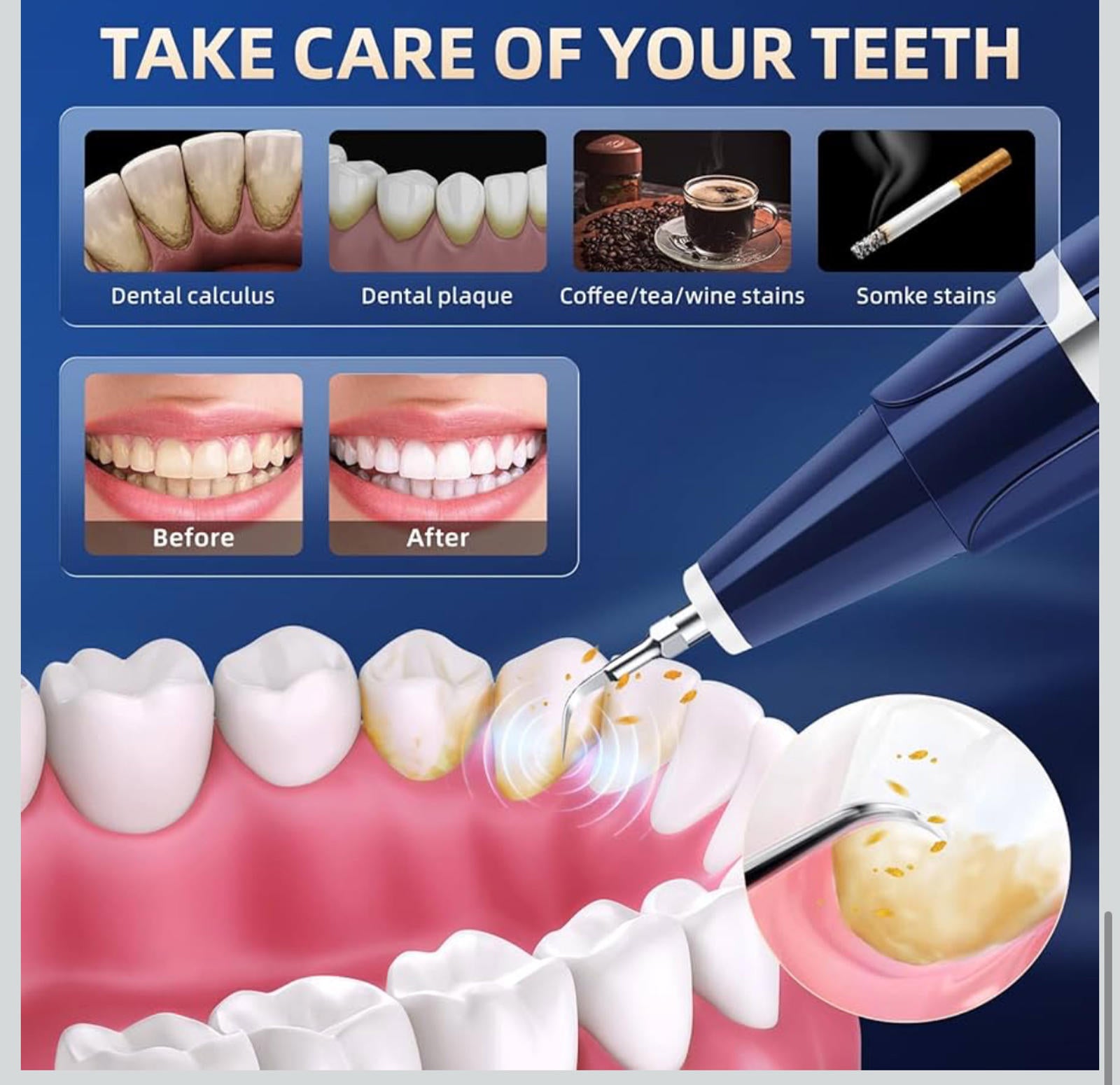 (NEW MSRP $45.99) Electric Teeth Plaque Cleaner Kit – Ultrasonic & USB‑C